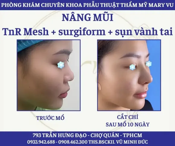 Tin tức