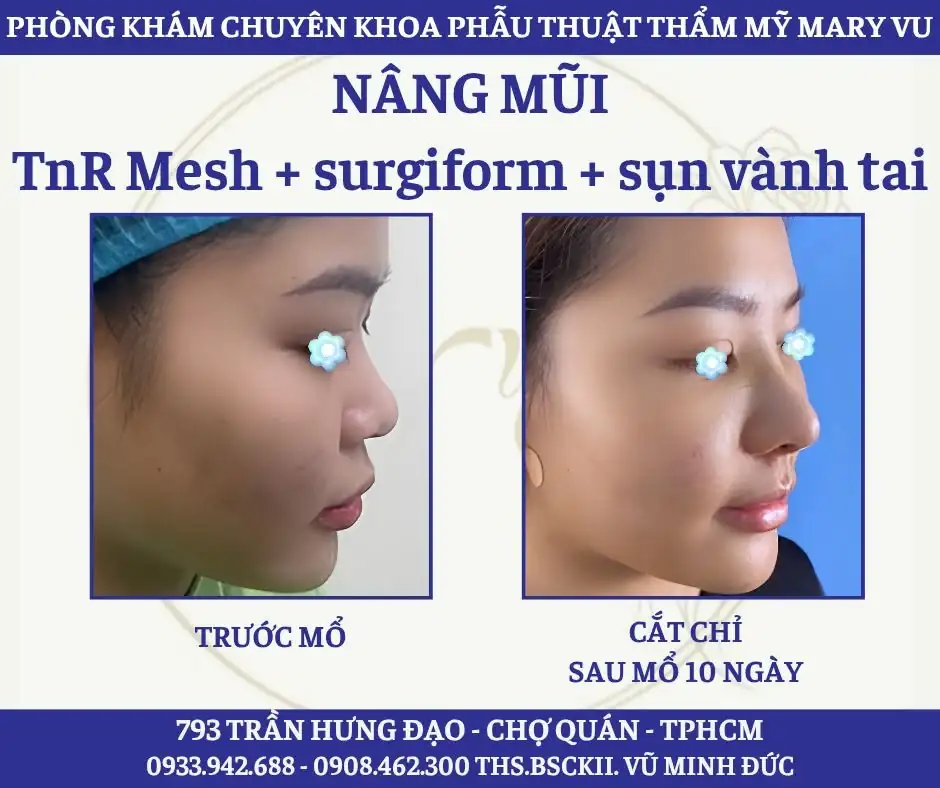 PK Phẫu Thuật Thẩm Mỹ Mary Vu